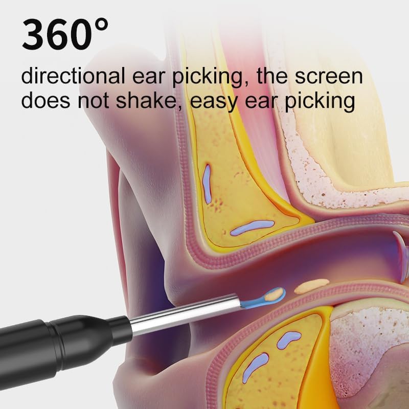 Smart Ear Cleaner with HD Camera | LED Light | Rechargeable | Compatible with Android & iPhone | Safe Silicone Tips | Ear Wax Removal Tool