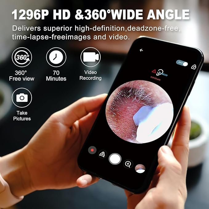 Smart Ear Cleaner with HD Camera | LED Light | Rechargeable | Compatible with Android & iPhone | Safe Silicone Tips | Ear Wax Removal Tool